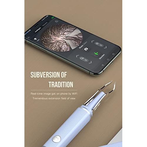 Hair Removal Tweezer with 1080p Camera, Ultimate Precision: Tweezer with Camera - Perfect for Delicate Tasks! - - Ear Hair Eyebrow Tweezer