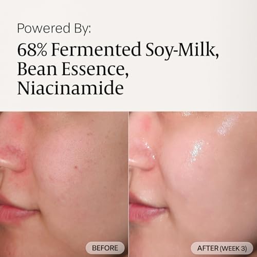 Fermented Tofu Collagen Serum ? 68% Fermented Soy Milk with Niacinamide & Hyaluronic Acid ? Korean Hydrating Face Serum for Firming, Radiance & Skin Barrier Care (1.01 fl oz / 30ml)