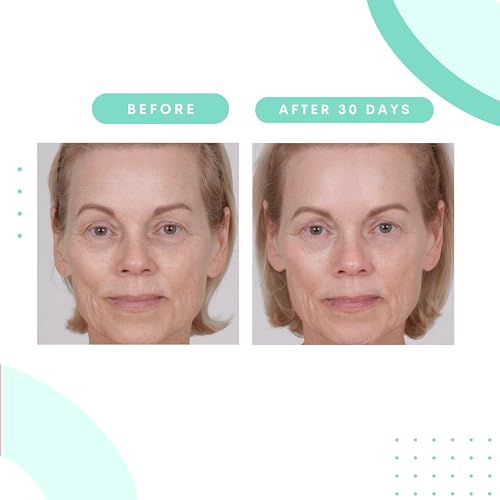 Serious Skincare Glycolic Cleanser - Skin Exfoliating Face Wash - 10% Glycolic Acid - Deep Pore Purifying - Removes Makeup, Oil, Blackheads and Impurities - Shave Prep - Anti-Aging 12 Fl. Oz.