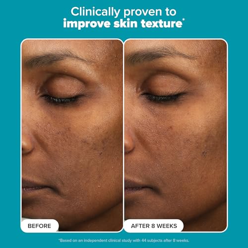 Paula¡¯s Choice 6% Mandelic Acid + 2% Lactic Acid Exfoliant, Gentle Daily AHA Exfoliation for Discoloration, Bumpy Texture & Radiance, for Sensitive Skin, Fragrance-Free