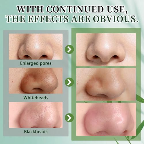 Blackhead Remover Mask, Charcoal Peel Off Face Mask Kit, Deep Cleaning Whiteheads Pore Mask, Oil Control, Men & Women Black Head Remover for Face Care ? 100g Includes Brush, Pimple Extractors