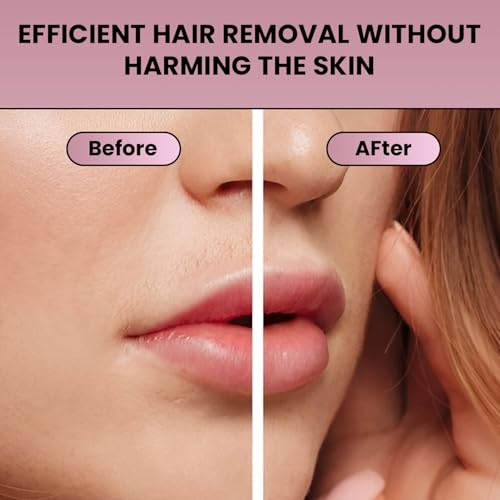 Facial Hair Remover for Women ? Electric Face Razor with Light, Hair Removal for Upper Lip, Chin & Cheeks ? Color Rose Red