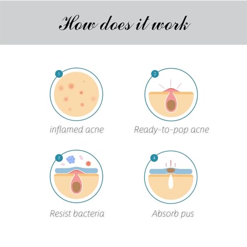 Acne Clear Hydrocolloid Patches with Powerful Blend Of Salicylic Acid, Tea Tree Oil & Centella Asiatica for Treating Zits, Blemishes & Stubborn acne. Fast-Acting Acne Care (72 patches)