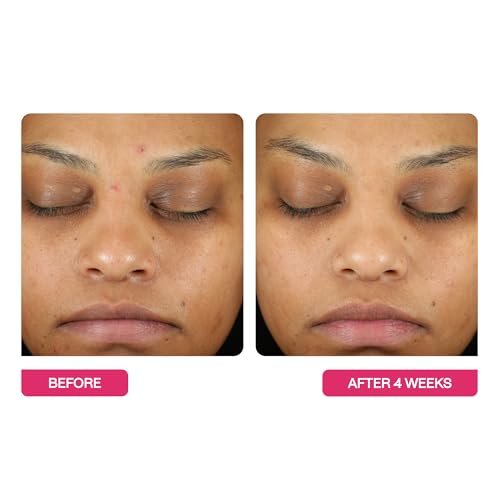 BeautyStat Triple Action One-Step Daily Exfoliating Peel Pad for Uneven Tone, Texture, Fine Lines, Enlarged Pores - Gentle Exfoliator Pad with AHAs, BHAs, Glucosamine to Brighten