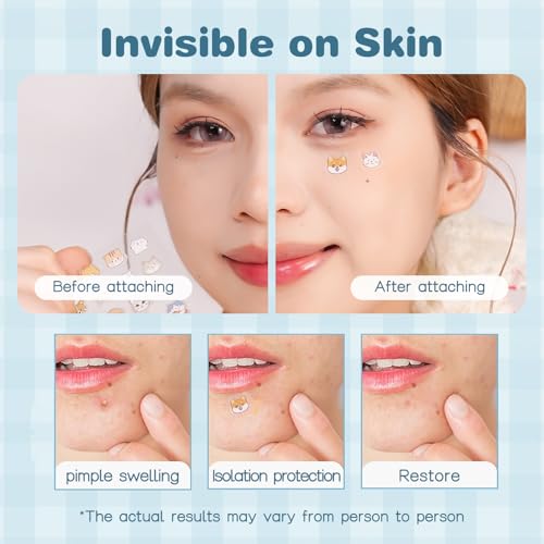 VENROCK Pimple Patches for face,24 Cute Pet Shapes 48 Count Hydrocolloid Acne Treatment for Covering Zits & Blemishes Spot for Kids & Adults, with Salicylic Acid, Tea Tree Oil, Centella Asiatica Oil