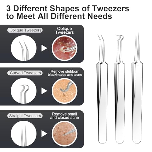 Pimple Popper Tool kit Blackhead Remover Comedone Extractor Kit with Box for Easily Remove blackheads, Acne, Blemishes, Whiteheads, pimples and Papules from The face and Bonus Gift -11pcs