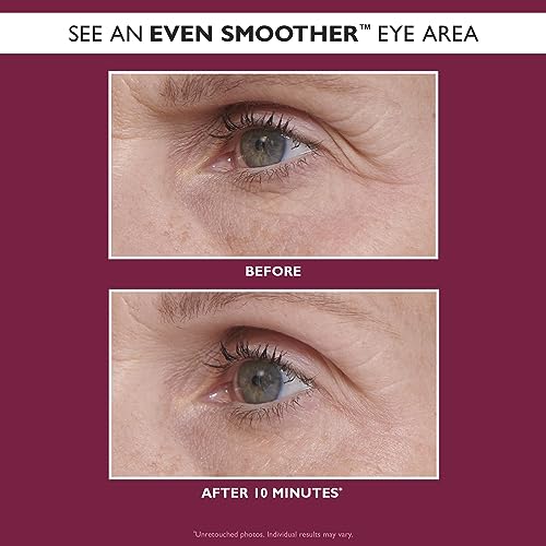 Peter Thomas Roth | Even Smoother¢â Glycolic Retinol Hydra-Gel Eye Patches, Under-Eye Patches With Glycolic Acid and Retinol, Treats Tiny Bumps, Texture, Fine Lines and Wrinkles Under the Eye Area