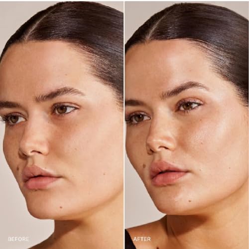 M Great Skin Instant Glow Serum with Niacinamide and Hyaluronic Acid (1.69 oz / 50 ml) + Bonus Acne Patch (36 Pieces) Tea Tree Oil Facial Water Gel