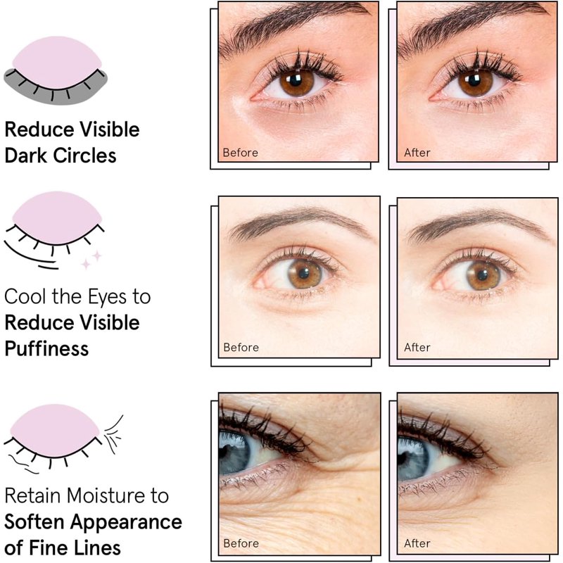 Illuminating Under Eye Mask Set for Dark Circles & Puffiness - 6 Pairs