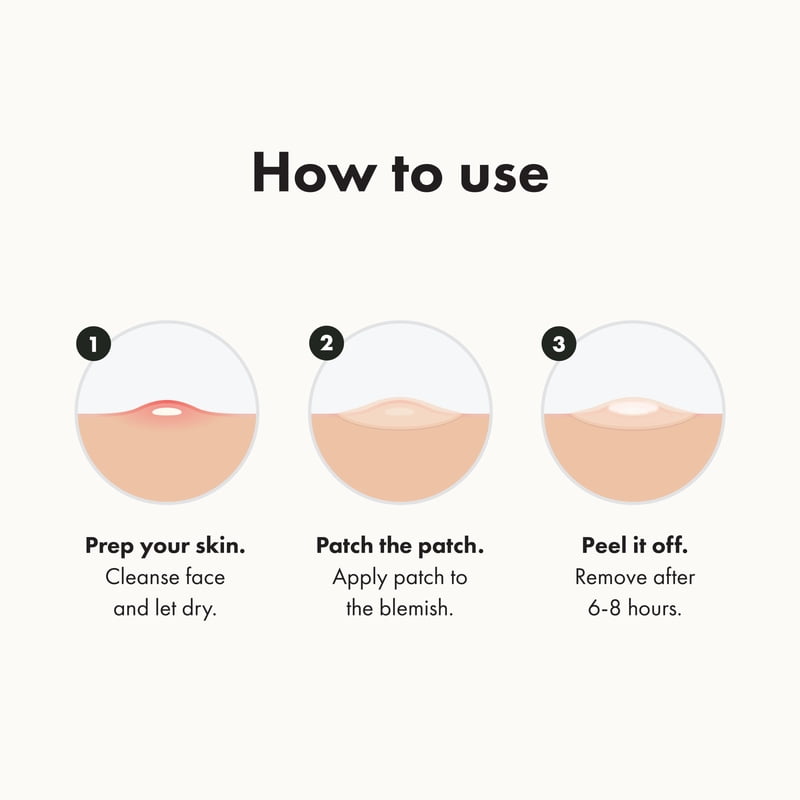 Hydrocolloid Acne Patches Set for Face Whiteheads - 24, 72, 144 Count