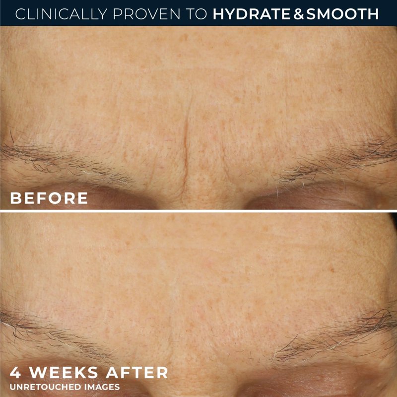Retinol and Hyaluronic Acid Face & Neck Moisturizer - 48-Hour Hydration, Anti-Aging Cream 1.7 oz