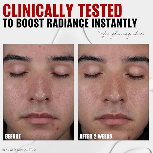 Thayers 2% AHA Exfoliating and Brightening Toner with Glycolic Acid, Lactic Acid and Witch Hazel, Smoothing and Pore Refining Skin Care for All Skin Types, 12 Fl Oz?