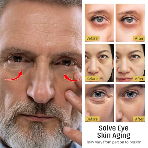 UOG (United One) Eye Serum Complex ? Rapid Reduction Eye Serum for Dark Circles, Puffiness, Wrinkles & Crow¡¯s Feet | Anti-Aging Formula for Firm, Youthful Eyes | Hydrates & Smooths (20ml / 0.7oz)