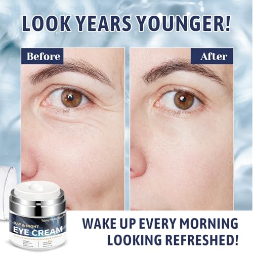 Day & Night Eye Cream with 6% Caffeine, Collagen, Retinol & Niacinamide - Anti-Aging, Deeply Moisturizing and Firming Eye Cream for Dark Circles, Puffiness, Fine Lines & Wrinkles, 1.76oz