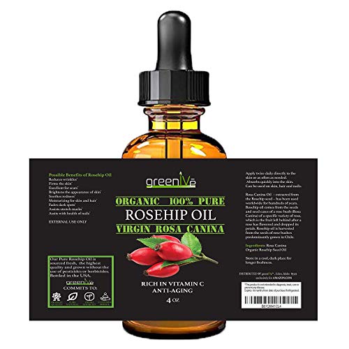 GreenIVe Rosehip Oil Rosa Canina 100% Pure Cold Pressed Virgin Oil Hair and Skin and DIY products (4oz dropper)