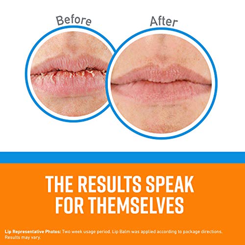 O'Keeffe's Cooling Relief Lip Repair Lip Balm for Dry, Cracked Lips, Stick, (Pack of 8)
