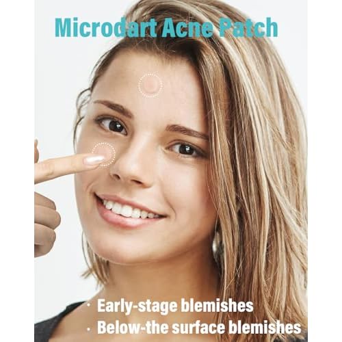 Microdart Acne Patch (36 Patches) - Hyaluronate Acid & Salicylic Acid Hydrocolloid Pimple Patch for Deep, Early and Hidden Blemishes (36 Count (Pack of 1))