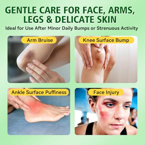 Arnica Bruise Cream, Advanced Formula Arnica Cream for Bruising and Swelling with Plant Extract, for Thin Skin on Face and Body 4 oz