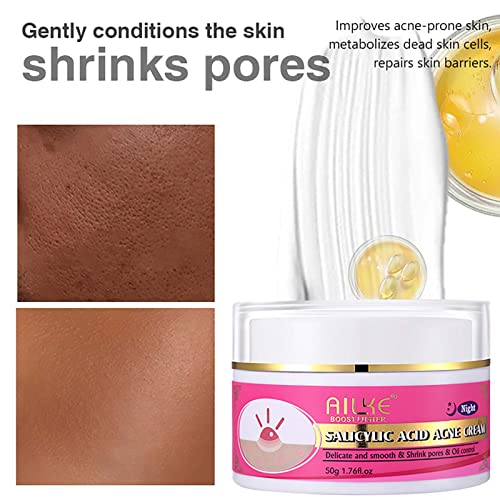 Salicylic Acid Acne Spot Removal Cream, Effectively Defeats Acne-Prone Skin, Refreshing, Oil Control, Prevent Breakouts, Pimples & Blackheads Remove Face Cream 1.76 oz