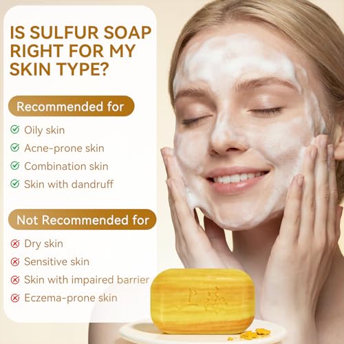 Bee & Flower Shanghai Sulfur Soap 10% Sulfur Soap Bar Face and Body Acne Treatment Sulphur Bar Soaps 3.4 Oz (4 Packs)