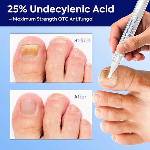Nail Fungus Treatment Extra Strength: 25% Undecylenic Acid Formula - Toenail Fungus Treatment Kit with 5 Pens & Nail File for Ingrown Nails, Discoloration & Brittle Nails