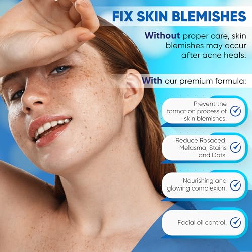 Azelaic Acid Cream: Azelaic Acid For Face - Premium Azelaic Acid Cream - Face Skin and Beauty Care - Azelaic Acid Facial Cream (1 Oz)