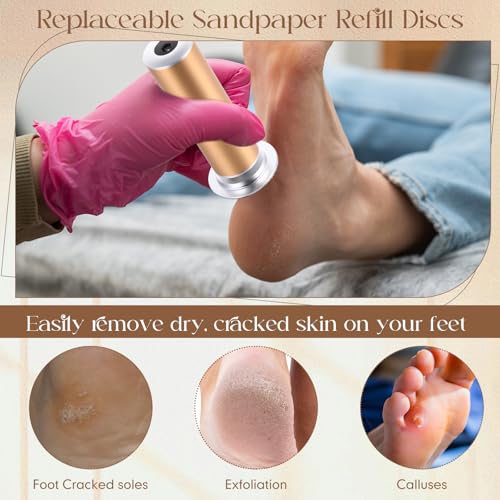 Gisafai 500 Pcs Sanding Replacement Pad Sandpaper Disk for Electric Foot File Callus Remover Tool Black Foot File Disc for Men Women Cracked Heels Dead Skin(80 Grit)