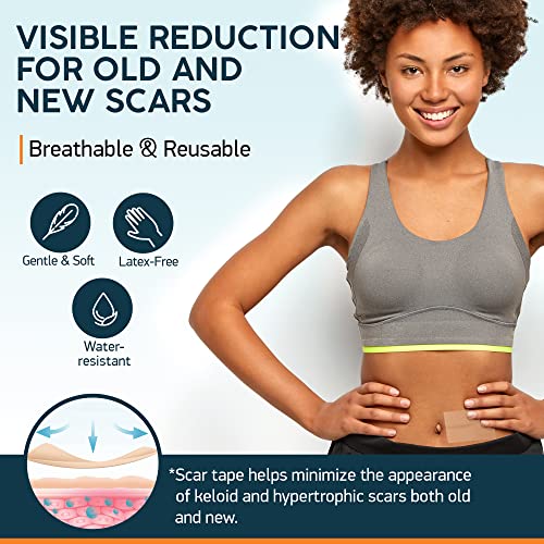 Nuvadermis Scar Sheets & Tape Bundle - 60-Day Supply for Comprehensive Scar Treatment