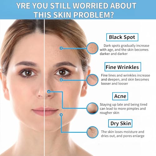Niacinamide 10% + Zinc 1% Serum for Face ? Oil Control, Acne, Pore Minimizer & Blemish Reduction ? Lightweight, Non-Greasy Facial Serum, 30ml (1 Fl Oz) (1)