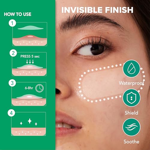 SoloVegan 55Count Don't Pop to Me Blemish Patch, Invisible Spot Cover, Hydrocolloid Acne Patch, Treatment for Breakouts, Absorbs Zits & Blemish, Korean Skin Care (55pcs (1PK))