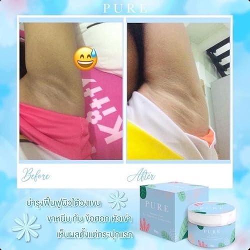 PURE Underarm Cream Toning Essence 50g Bikini Line Dark Spot