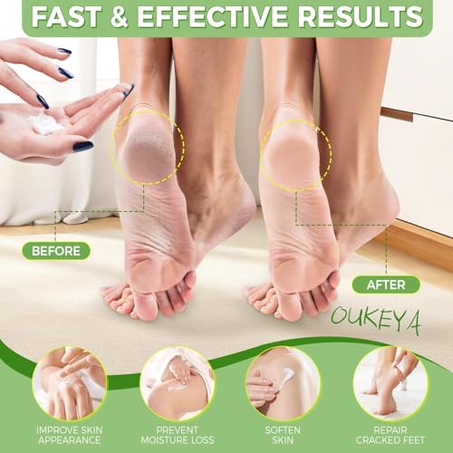 OUKEYA 40 Percent Urea Foot Cream,with Salicylic Acid,Tea Tree Oi & Ceramides,Cracked Heel Smooth | Dry Skin Exfoliator | Nourishes | For Foot,Hands, Elbows, Knees 5.29 Oz