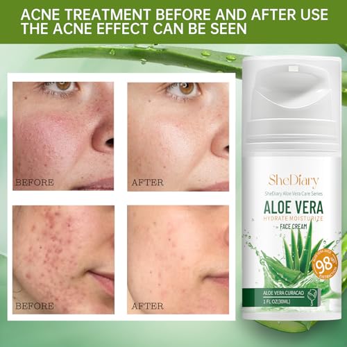 SheDiary Natural Aloe Vera Face Cream for Acne-Prone Skin - Plant-Based Formula to Hydrate, Firm, and Brighten Dull & Aging Skin 30ml