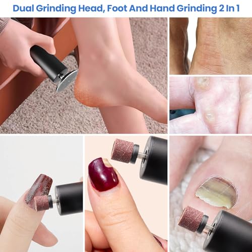 Electric Callus Remover for Feet and 120 pcs Replacement Sandpaper Refill Discs