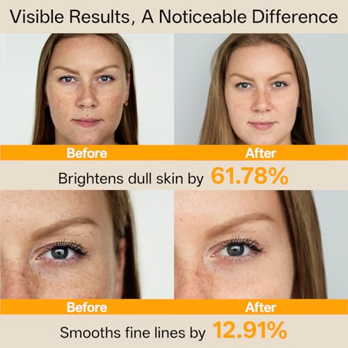 WNP Vitamin C Serum for Face - Dermatologist Tested Anti-Aging & Brightening with Hyaluronic Acid & Vitamin E, Treatment for Dark, Age, Sun Spot, Melasma, Hyperpigmentation, Fine Lines & Wrinkles