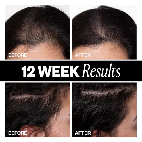 IGK Sponsored - Scalp Treatment for Hair Growth ? Hair Thickening Serum for Women ? Promotes Fuller, Thicker Hair ? Scalp Serum for Hair Density and Thinning - 2.1oz