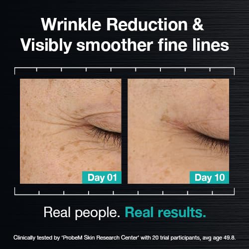 Advanced Wrinkle Repair Peptide Serum, Firming & Fine Line Smoothing, Fragrance-Free, 30 mL (Powered by PDRN 5% + Exosomes + Matrixyl¢ç 3000 Peptides)