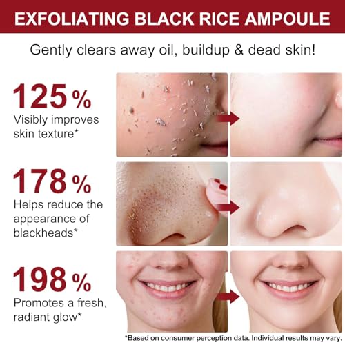 Black Rice Exfoliant and White Rice Ampoule Exfoliant, Peel Shot Glow Exfoliating Face Serum, Korean Skin Care Soft Exfoliating Body Scrub Dead Skin Cells, Blackheads Remover For All Skin Types 100ml