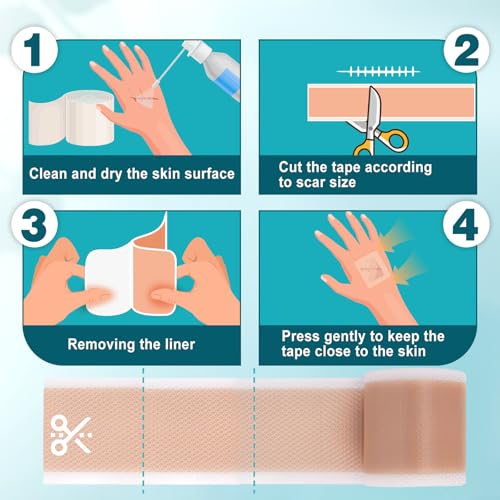 Arme Silicone Scar Tape, 1.6" x 240" Silicone Scar Sheets(2 Rolls-6M), Medical Grade Scar Tape Removal Sheets for Surgical Scars, Reusable Scar Removal Strips for Tummy Tuck C-Section Keloid