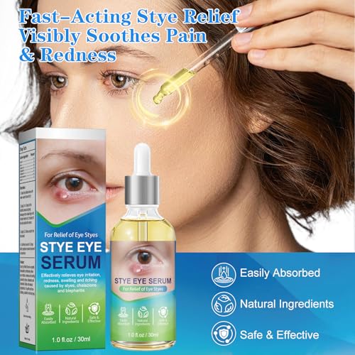 Stye Eye Relief Serum & Eyelid Drops for Blepharitis, Chalazion Styes Redness | Under Eye Serum Natural, Stye Drops for Infected Eyes Fast-Acting | Gentle Care 30ml