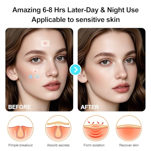 Pimple Patches for Face, Various styles, colors, Large Hydrocolloid Pimple Patches, 150 Count Pimple Patche, Good for blemishes with a head and visible gunk, With a Cute mirror case