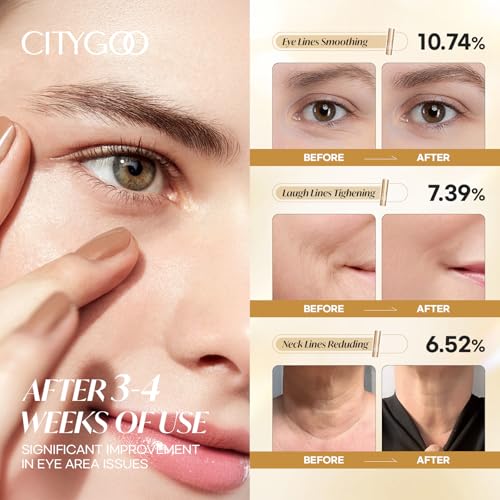 CITYGOO Retinol Eye Stick Hydrating: Dark Circle & Puffiness Balm with Retinol & Collagen - Anti Aging Wrinkle Cream For Women - Travel Friendly and Korean Skin Care (Retinol 10G)