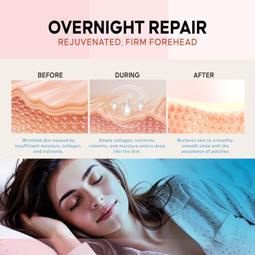 Forehead Wrinkle Patches Overnight : Forehead Fine Lines and Deep Wrinkles Treatment Remover, Anti Forehead and Between the Eyes Facial Wrinkle Patches, Hypoallergenic Patches with Collagen12 Pcs
