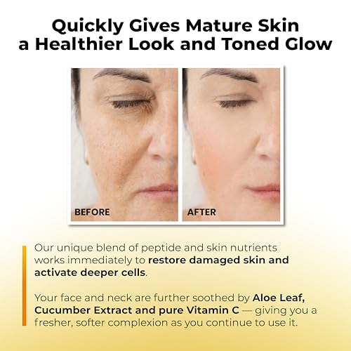 Dermacyl Vitamin C Serum for Face - Peptides c Total Package Serum with Hyaluronic Acid - All-in-One Vitamin Formula for Anti Aging, Hydration, Firms, Lifts, Targets Age spots - Fine Lines & Wrinkles