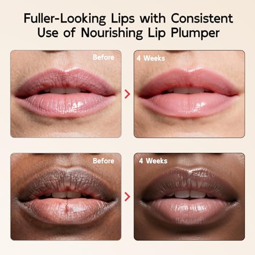 YouthVibe 5% Volufiline Lip Plumper, Nourishing & Anti Aging Over Time with Squalane, Shea Butter, Collagen, Peptide & PDRN - No Burning, No Tingling for Gentle Daily Plumping