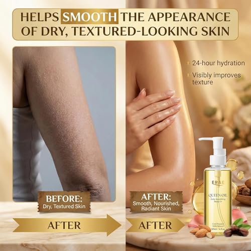 ERAE Queen Oil, Cold-Pressed Botanical Body Oil, Lightweight Daily Hydrating & Moisturizing Oil for Arms, Tummy & Thighs, Deeply Nourishing, 2 Pack (120 ml / 4 fl oz Each) (2 PCS)