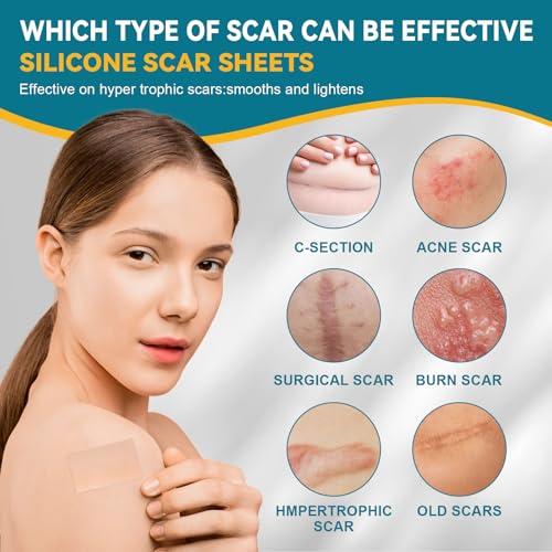 Silicone Scar Tape for Surgical Marks Face Stick Keloid Cover C-Section Strips Wrinkle Cream Lip Sleeping Gel Sheet Tummy Patch Hydrocolloid Roll Soft (1 Pack, 1.6"X 120")