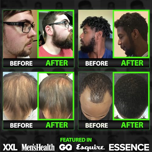 GROW Beard Growth Serum + 2X Biotin Beard Balm ? Thickening Conditioner with Castor Oil & Meadowfoam ? Fills Patches, Boosts Growth, Softens & Styles ? For Thicker, Fuller Men's Facial Hair