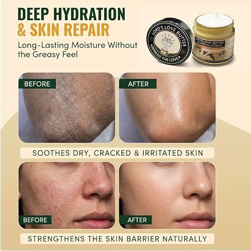 Natural Organic Tallow Balm For Skin That Rejects Synthetic Lotion - Handmade Beef Tallow and Manuka Honey Balm Face Moisturizer for Dry Cracked Hands and Aging Skin - Award Winning