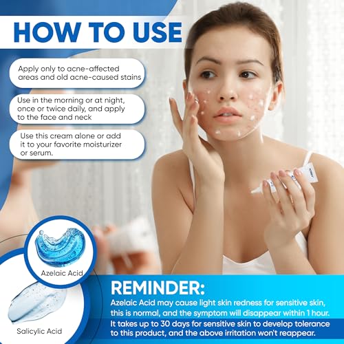 Azelaic Acid Cream: Azelaic Acid For Face - Premium Azelaic Acid Cream - Face Skin and Beauty Care - Azelaic Acid Facial Cream (1 Oz)